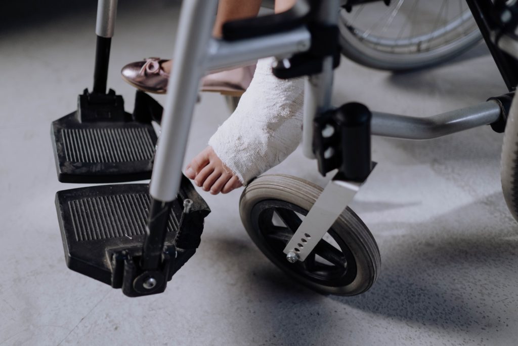 woman in a wheelchair with a broken foot